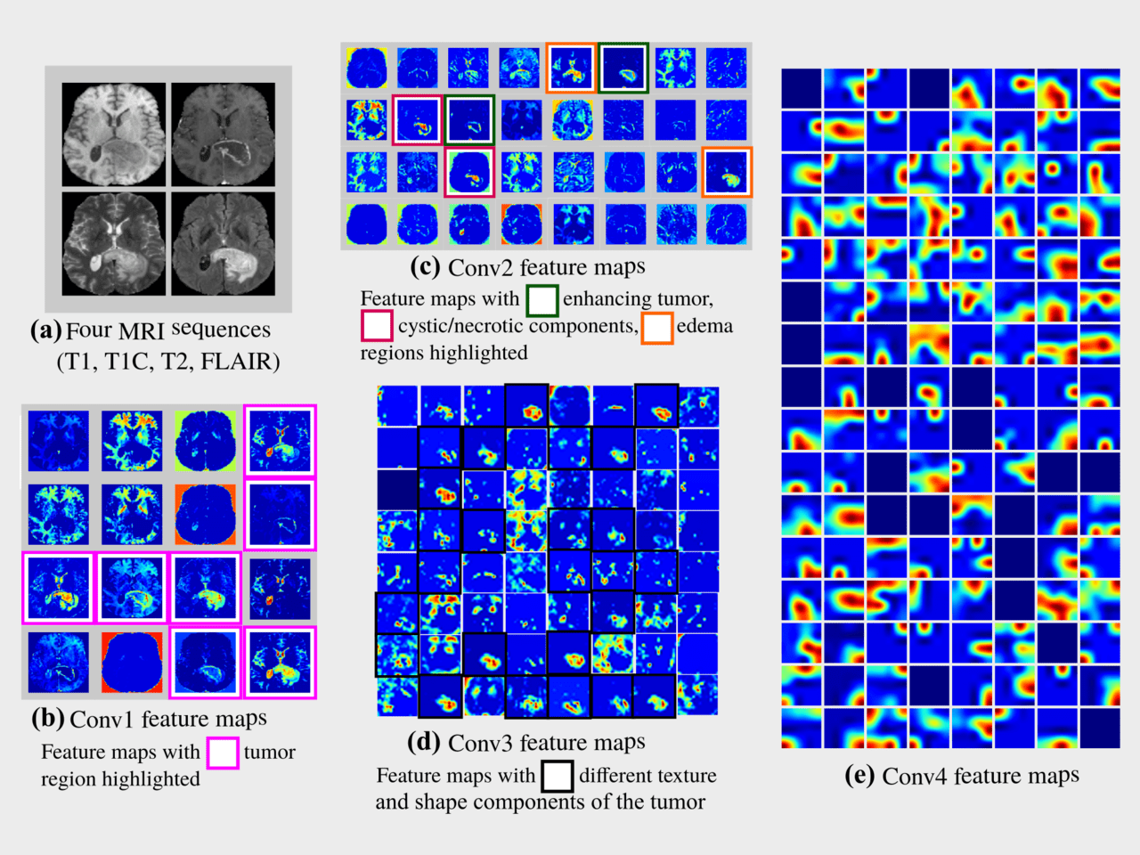 brain tumor detection using deep learning research paper