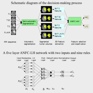 Synergetic Neuro-Fuzzy Feature Selection and Classification of Brain Tumors