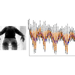 Non-contact heartbeats and respiration monitoring