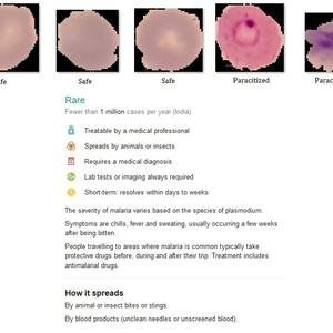 Malaria Detection from blood sample images using Intel® Distribution of OpenVINO™ Toolkit.