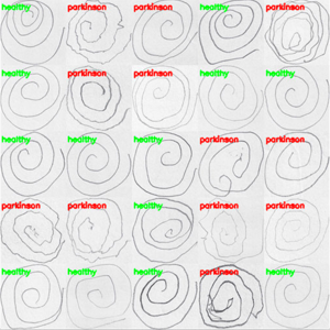 Parkinson's Disease Detection