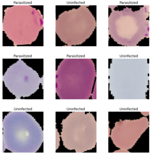 Malaria Detection with Deep Learning