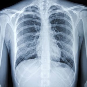 Mini blob?v=1644513580