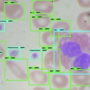 Blood Cell Detection using TensorFlow Object Detection API