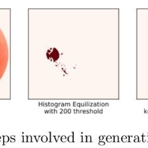 Optic-Disk-Cup-Segmentation
