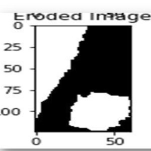Detecting Region of Interest (ROI) in Mammogram
