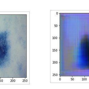 Medical Image Generation