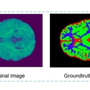 Infant Brain MRI Segmentation