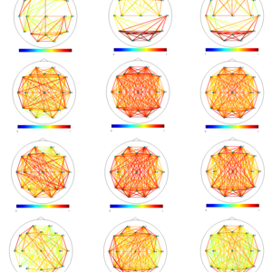 Brain Connectivity Analysis with Classification