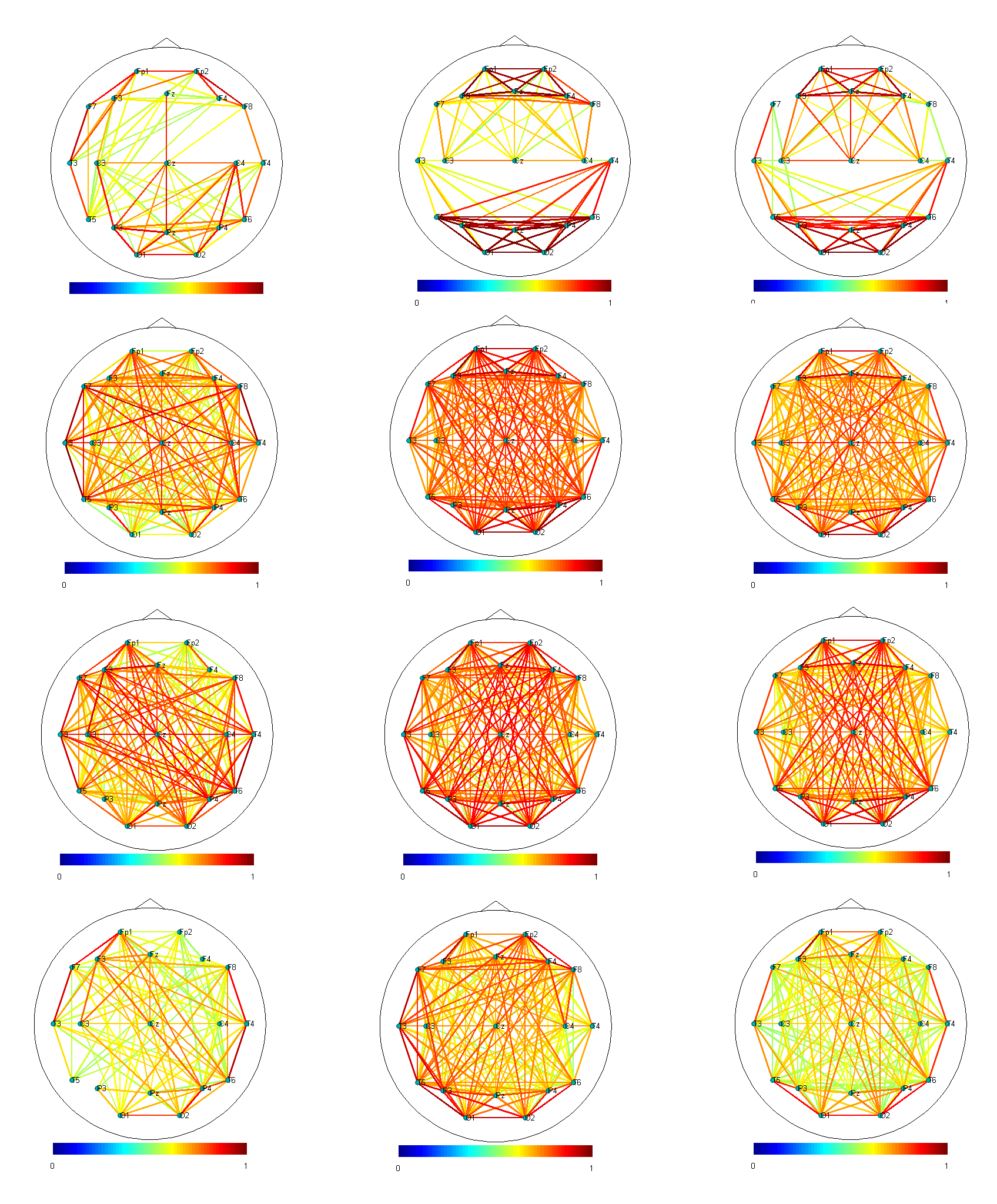 Brain Connectivity Task Decoding Brain Connectivity Analysis with Classification | Intel DevMesh ...
