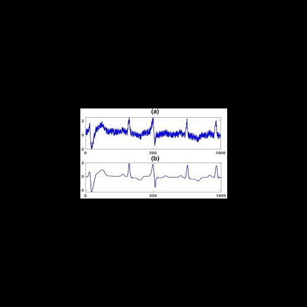 Categorisation of ECG