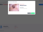 Hitaya OneAPI: Skin Cancer Detection using Intel® Optimization for Tensorflow