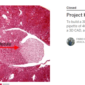 Project Kidney 3D Printed