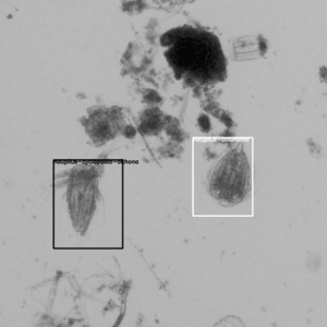 Zooplankton detection and measurement