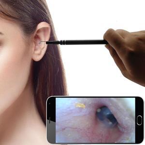 MyEndoscope