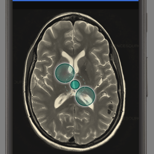 BioRis App