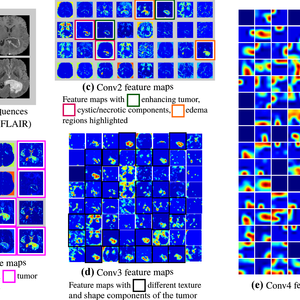 Brain Tumor Detection and Classification from Multi-Channel MRIs: Study using ConvNets