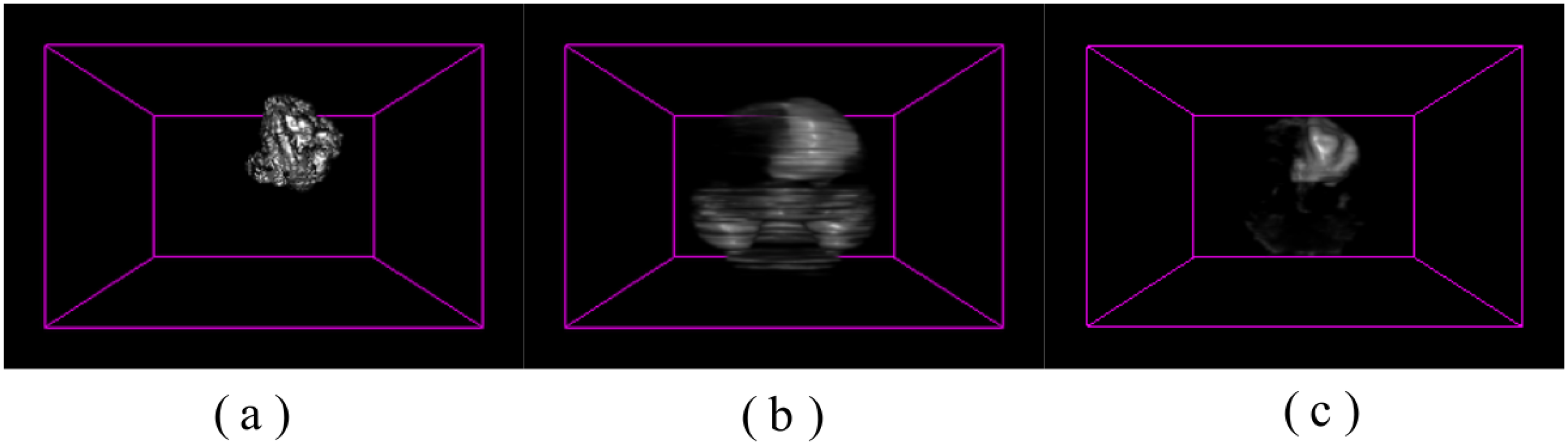 Volumetric brain tumour detection from MRI using visual saliency
